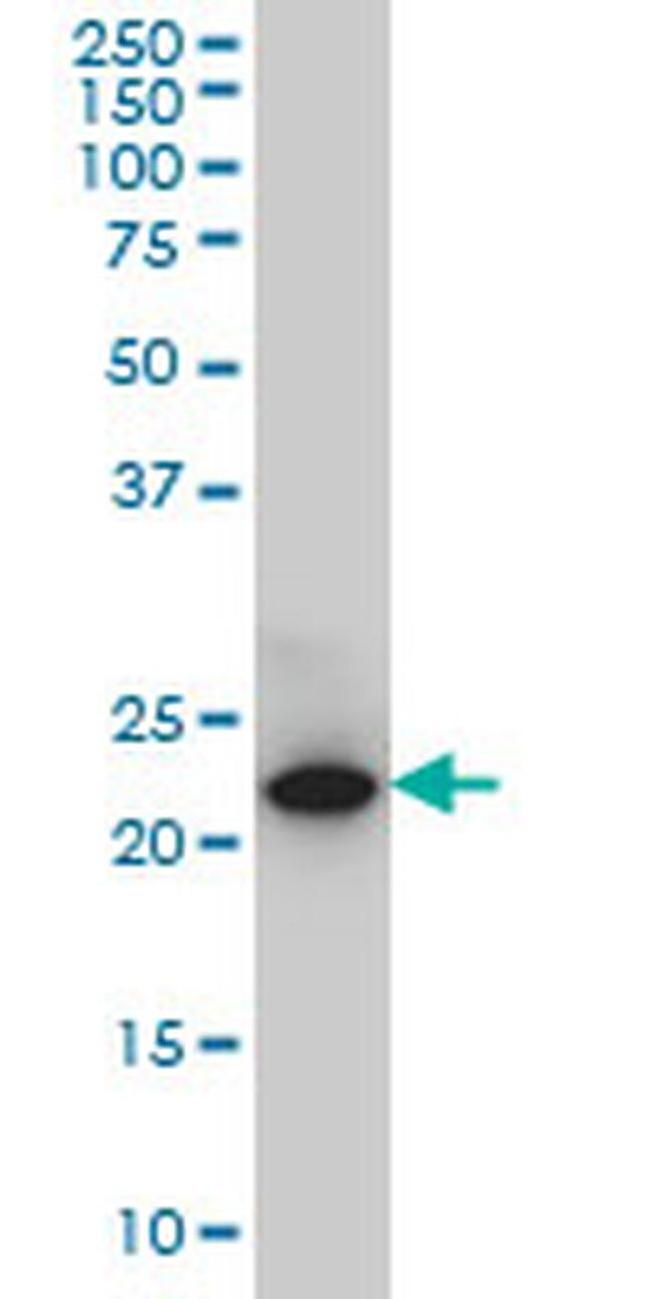 SPRYD7 Antibody in Western Blot (WB)