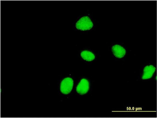 ZNF323 Antibody in Immunocytochemistry (ICC/IF)