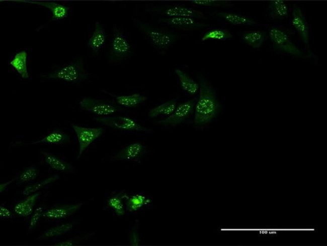 ZNF447 Antibody in Immunocytochemistry (ICC/IF)