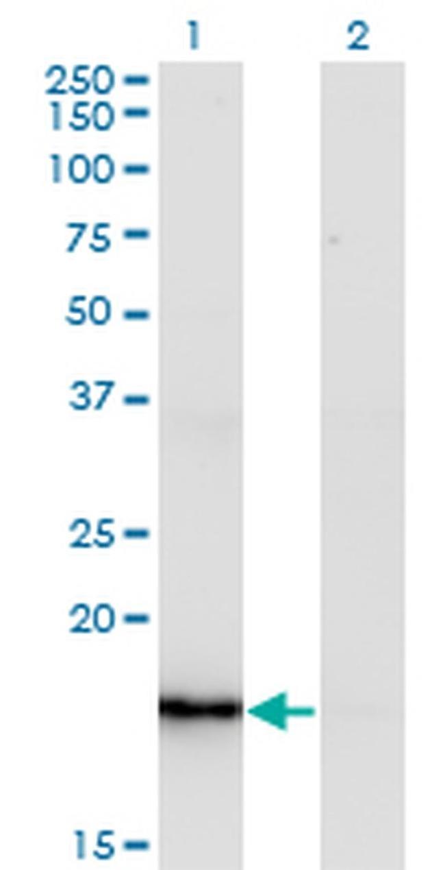 ZMAT4 Antibody in Western Blot (WB)