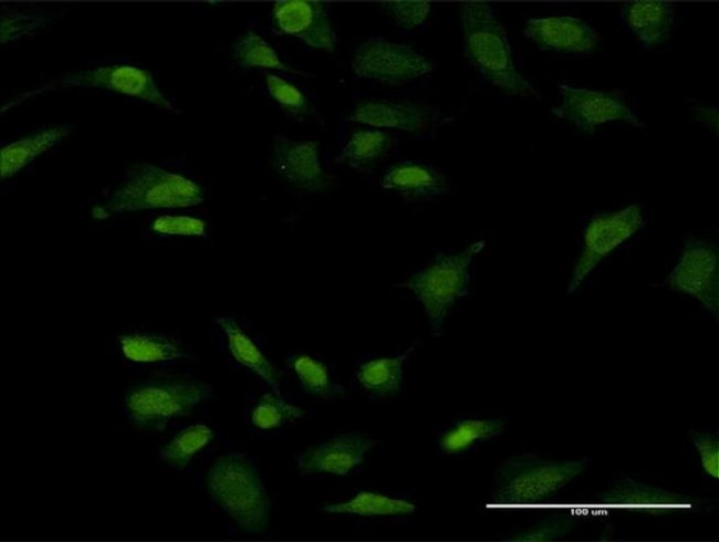PRKRIP1 Antibody in Immunocytochemistry (ICC/IF)