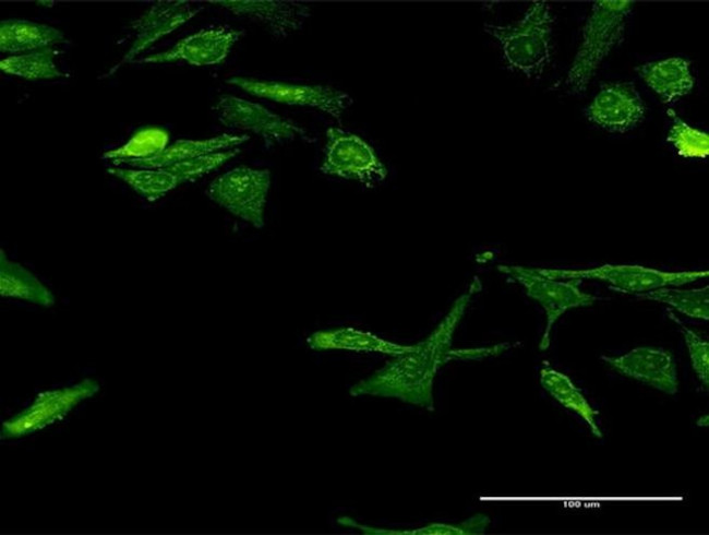 Gemin 7 Antibody in Immunocytochemistry (ICC/IF)