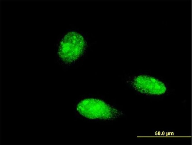 TRIM46 Antibody in Immunocytochemistry (ICC/IF)