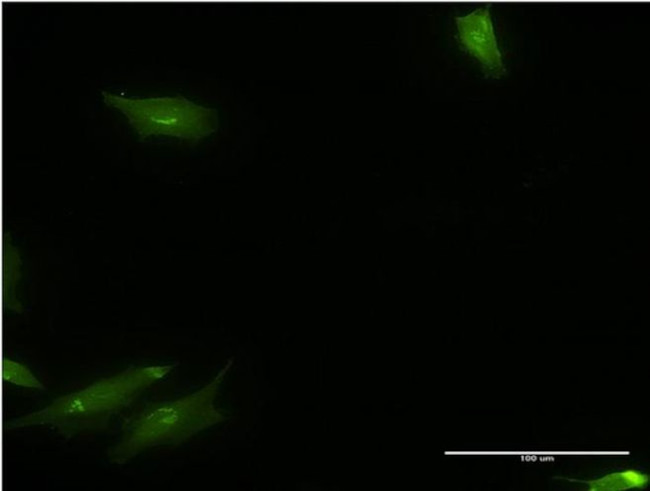 CaMKK alpha Antibody in Immunocytochemistry (ICC/IF)