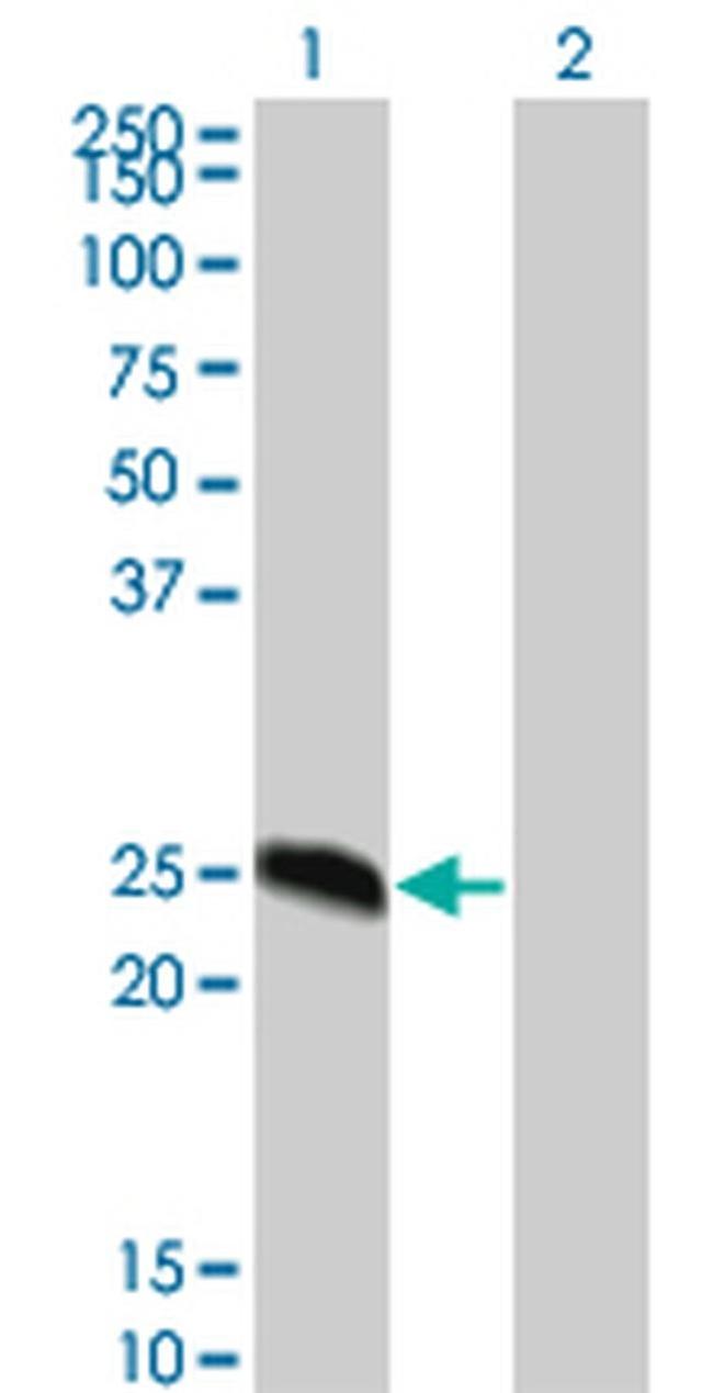DYDC2 Antibody in Western Blot (WB)