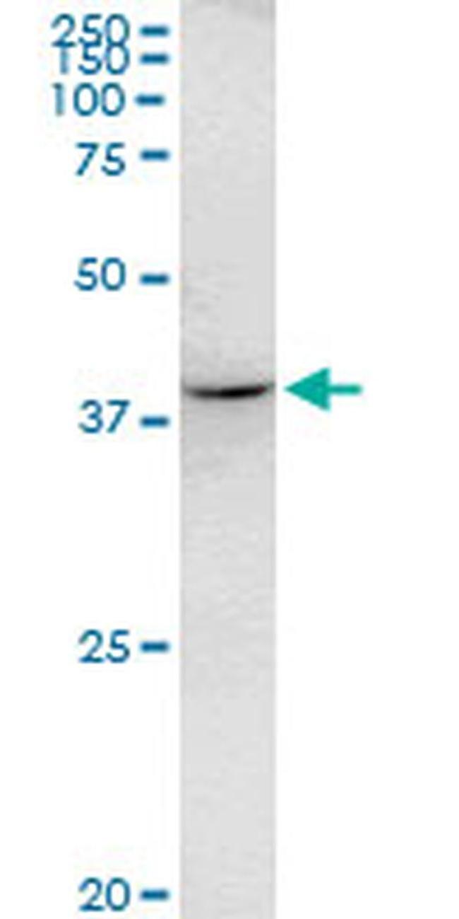 RHOXF2 Antibody in Western Blot (WB)