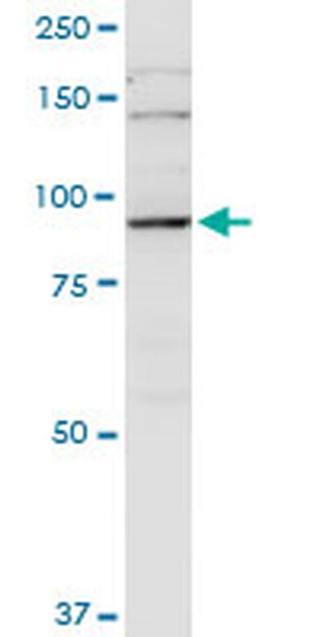 PGBD1 Antibody in Western Blot (WB)