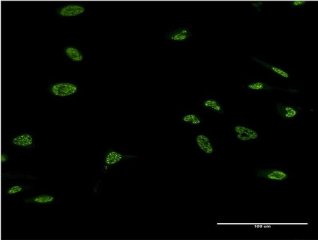 LHX4 Antibody in Immunocytochemistry (ICC/IF)
