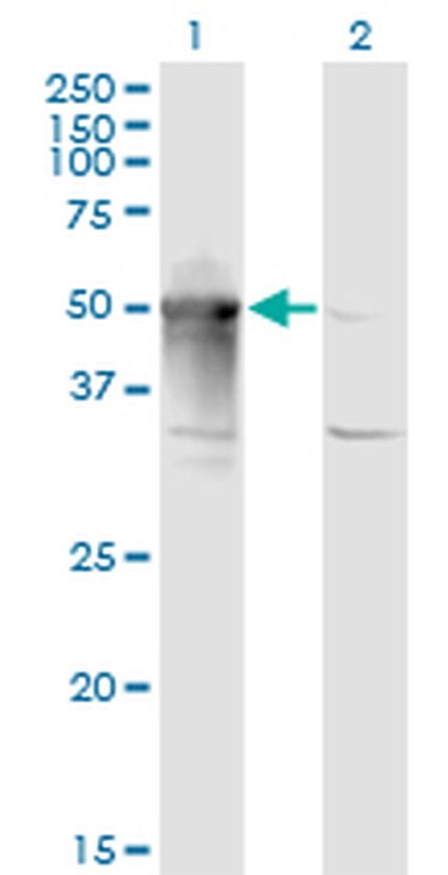 ARMC6 Antibody in Western Blot (WB)