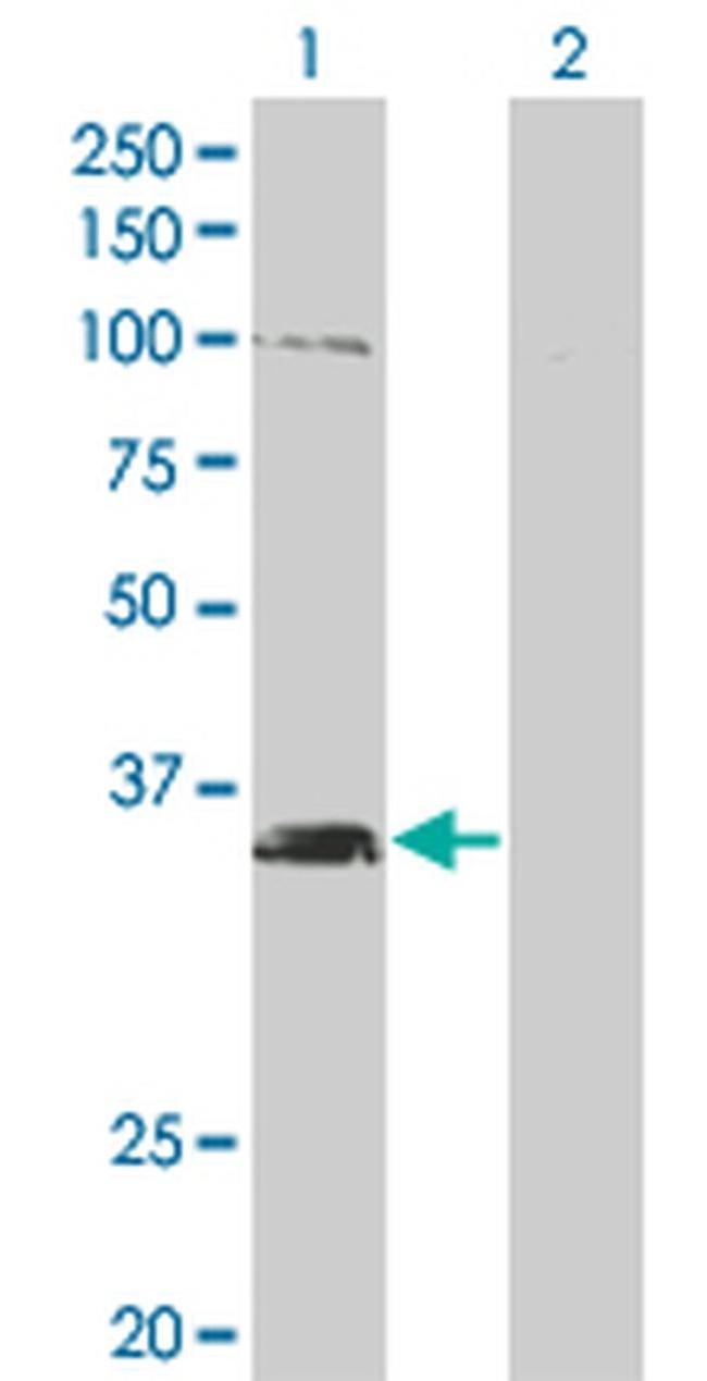 MSI2 Antibody in Western Blot (WB)
