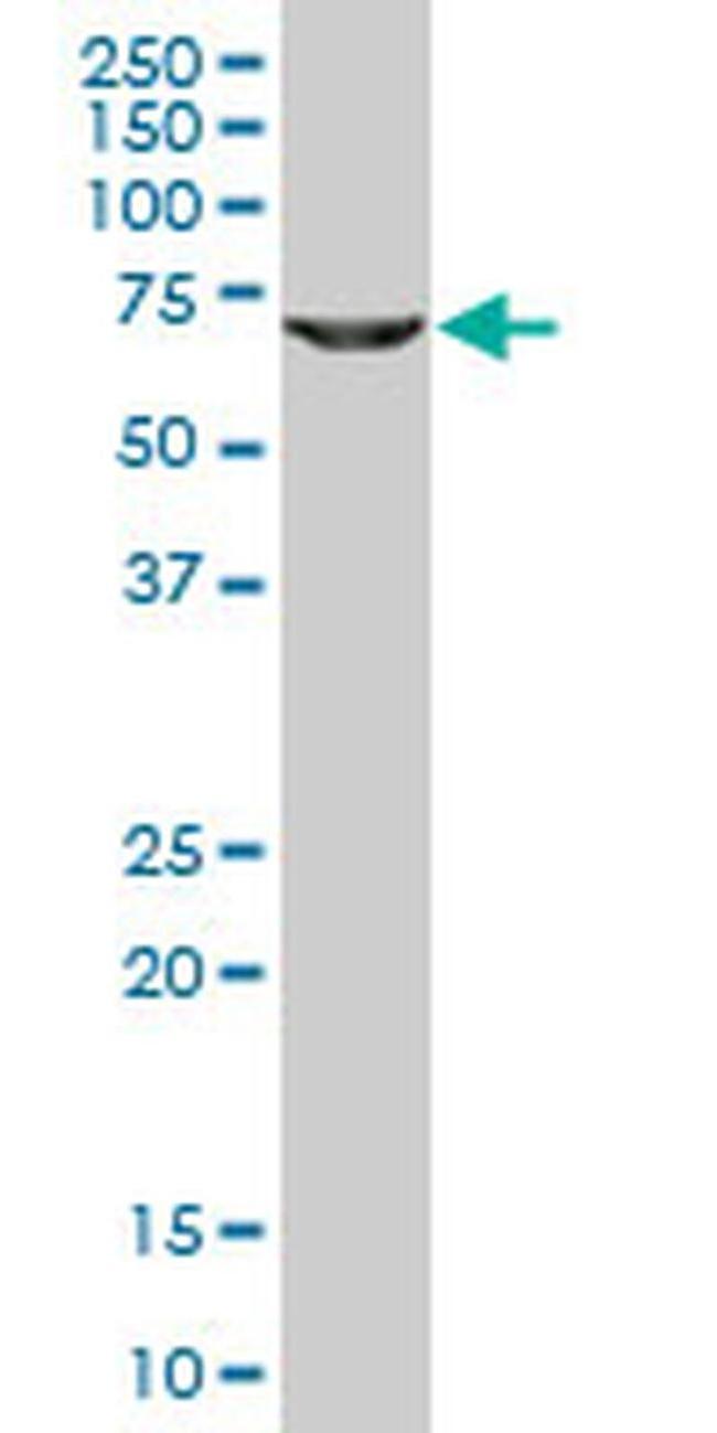 GLYCTK Antibody in Western Blot (WB)
