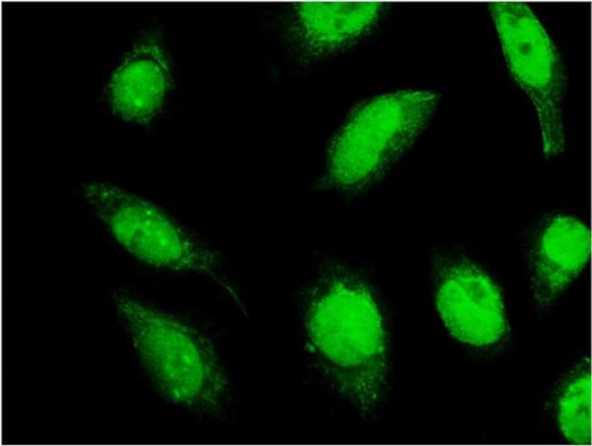 C18orf23 Antibody in Immunocytochemistry (ICC/IF)