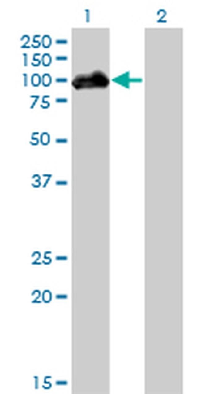 HIPK4 Antibody in Western Blot (WB)