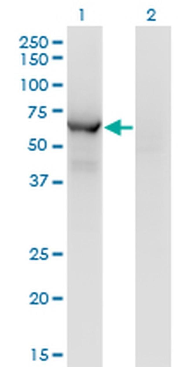 CESK1 Antibody in Western Blot (WB)