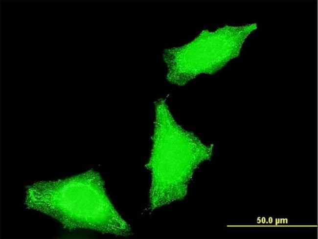 PPP1R2P3 Antibody in Immunocytochemistry (ICC/IF)