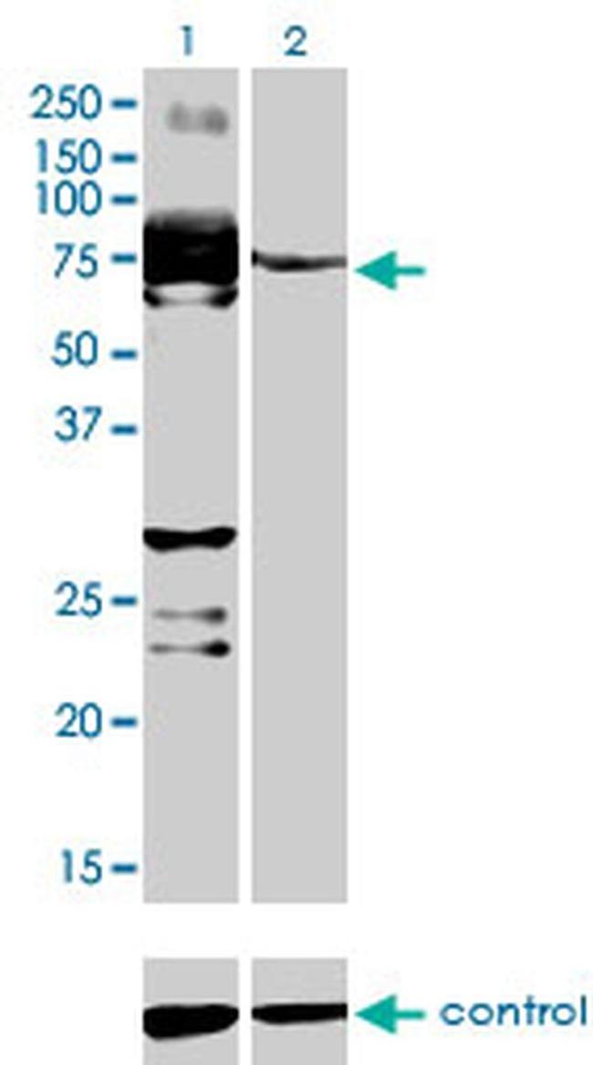 STKLD1 Antibody in Western Blot (WB)
