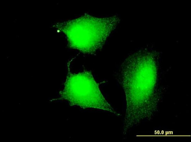 CCDC83 Antibody in Immunocytochemistry (ICC/IF)