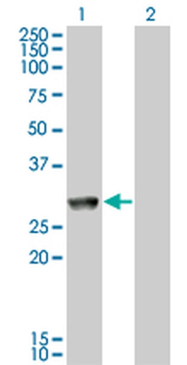 GK5 Antibody in Western Blot (WB)