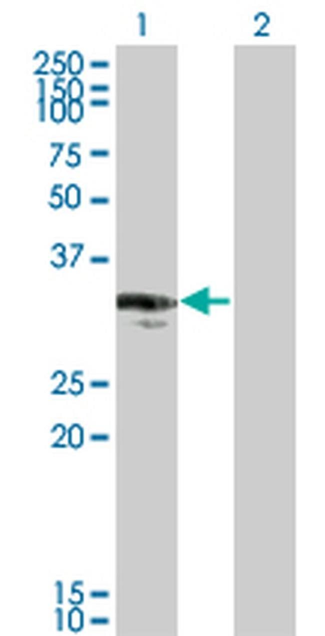 CENPP Antibody in Western Blot (WB)