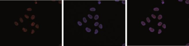 H3K4me1 Antibody in Immunocytochemistry (ICC/IF)