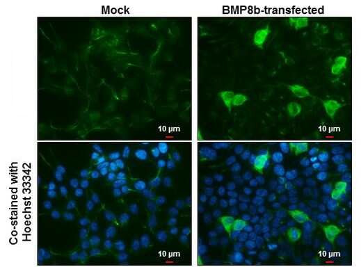 ZFP57 Antibody in Immunocytochemistry (ICC/IF)
