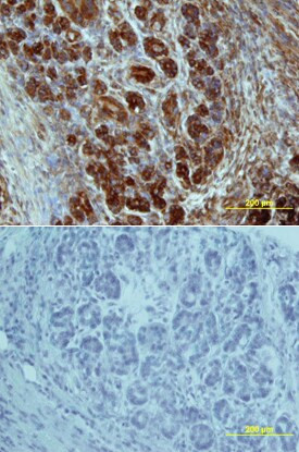 GLUT2 Antibody in Immunohistochemistry (Paraffin) (IHC (P))