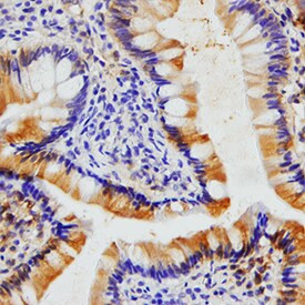 Eotaxin Antibody in Immunohistochemistry (Paraffin) (IHC (P))