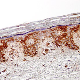 CCL27 Antibody in Immunohistochemistry (Paraffin) (IHC (P))