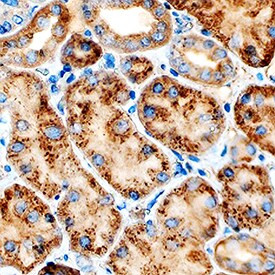 Cathepsin L Antibody in Immunohistochemistry (Paraffin) (IHC (P))