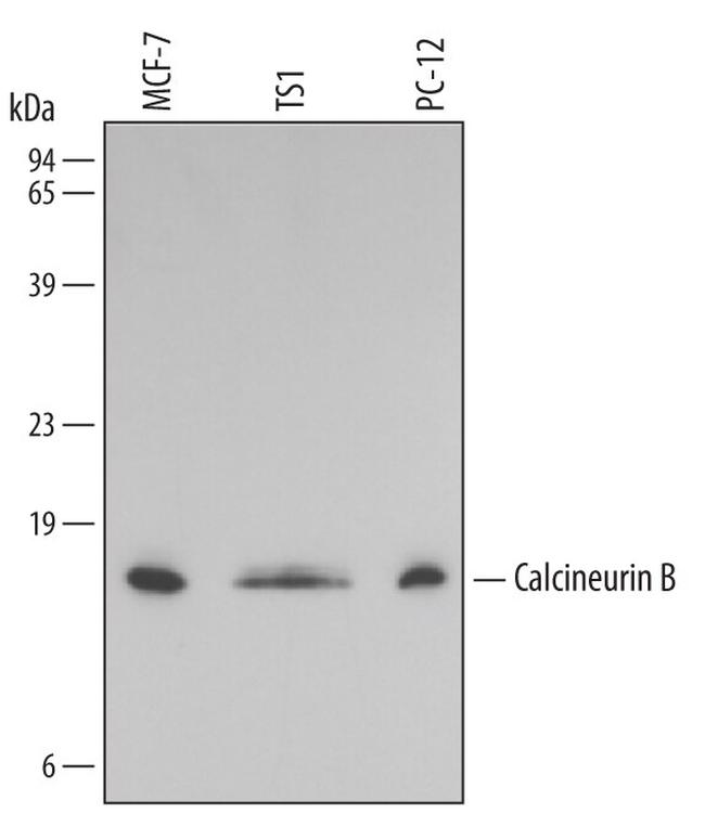 Calcineurin B Antibody in Western Blot (WB)
