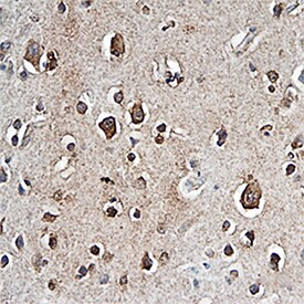 PTPRZ Antibody in Immunohistochemistry (Paraffin) (IHC (P))
