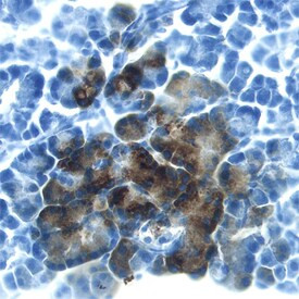 REG3B Antibody in Immunohistochemistry (Frozen) (IHC (F))