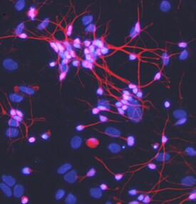 Meteorin Antibody in Immunocytochemistry (ICC/IF)