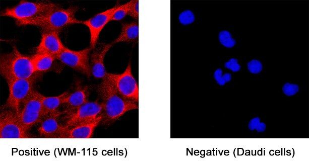 CADM4 Antibody in Immunocytochemistry (ICC/IF)