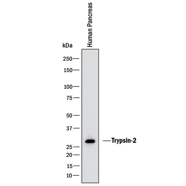 Trypsin 2 Antibody in Western Blot (WB)