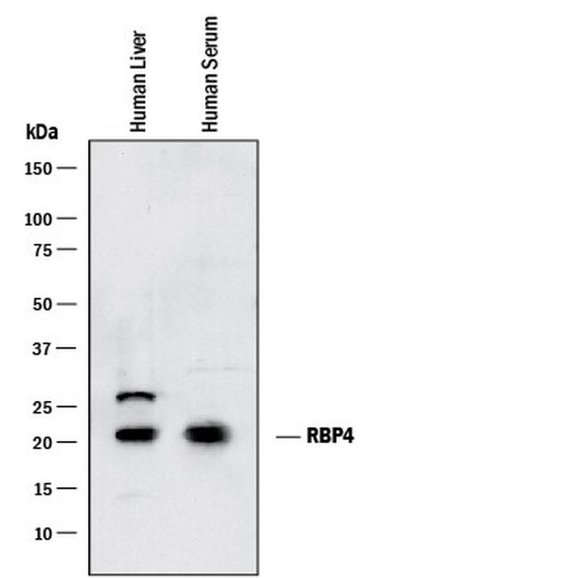 RBP4 Antibody in Western Blot (WB)