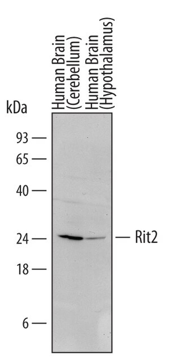 RIT2 Antibody in Western Blot (WB)