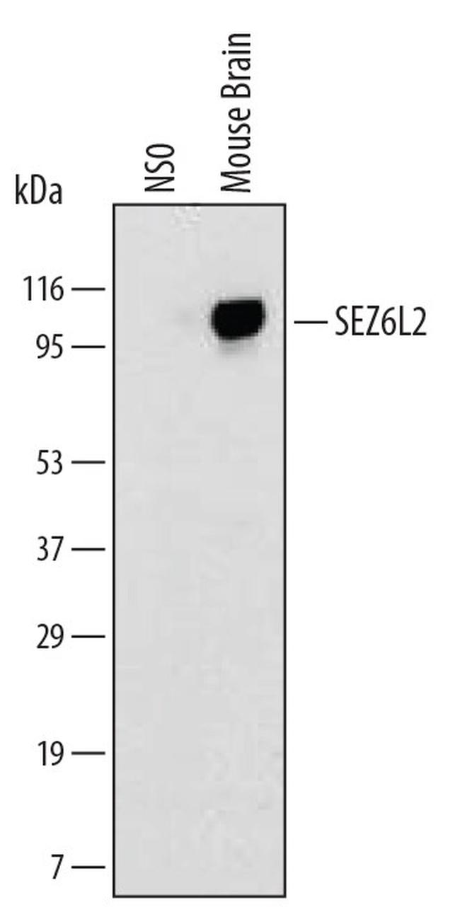 SEZ6L2 Antibody in Western Blot (WB)