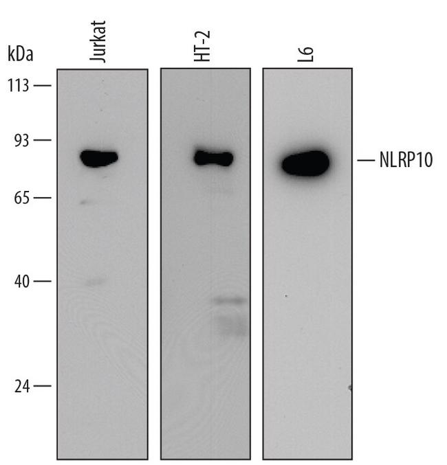 NALP10 Antibody in Western Blot (WB)
