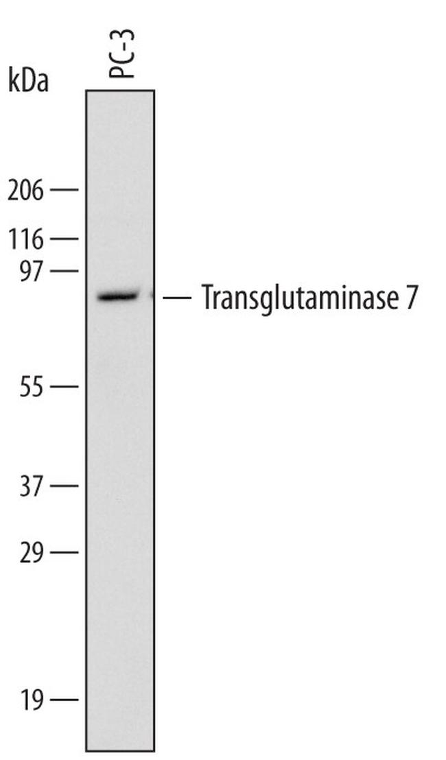 TGM7 Antibody in Western Blot (WB)