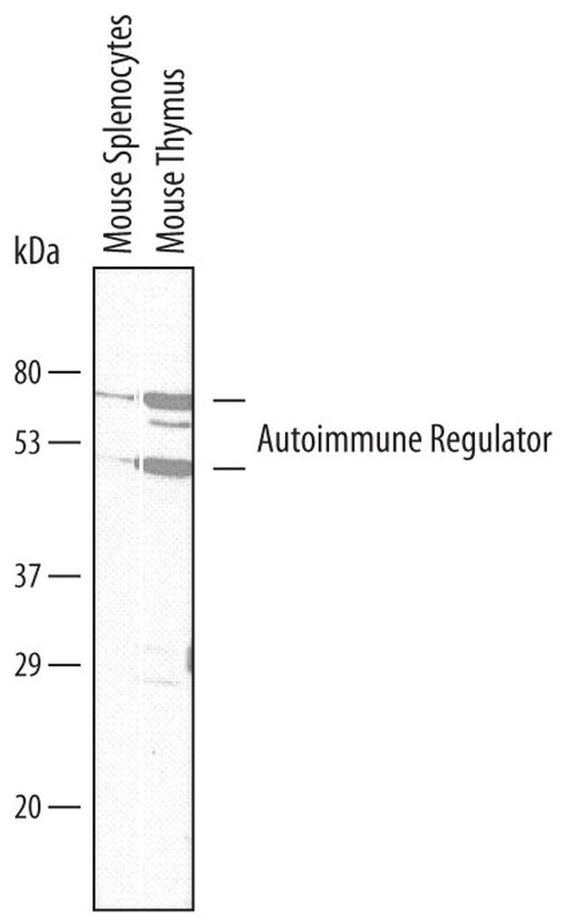 AIRE Antibody in Western Blot (WB)