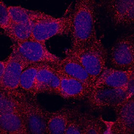 TMEM204 Antibody in Immunocytochemistry (ICC/IF)