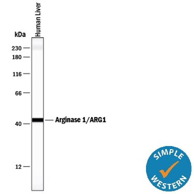 Arginase 1 Antibody in Western Blot (WB)