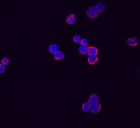 RARRES3 Antibody in Immunocytochemistry (ICC/IF)
