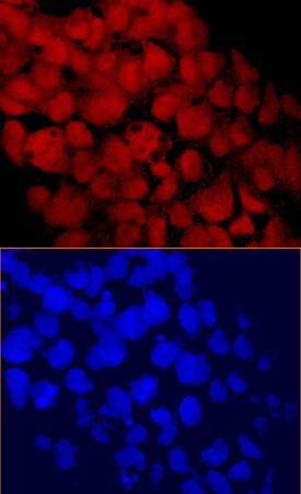 CHD1 Antibody in Immunocytochemistry (ICC/IF)