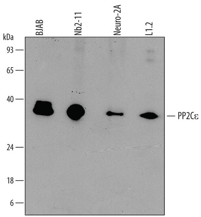 PPM1L Antibody in Western Blot (WB)