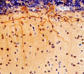 LRRC4B Antibody in Immunohistochemistry (Paraffin) (IHC (P))