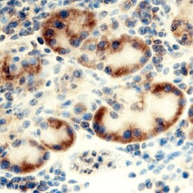 RPL17 Antibody in Immunohistochemistry (Paraffin) (IHC (P))
