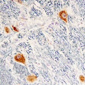 Cerebellin 2 Antibody in Immunohistochemistry (Paraffin) (IHC (P))