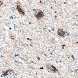 HEXA Antibody in Immunohistochemistry (Paraffin) (IHC (P))
